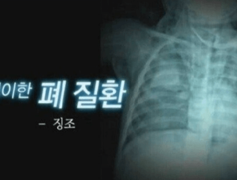 한국에서만 발견된 기이한 폐 질환