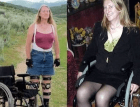 장애는 없지만 휠체어를 타고 다니는 여자